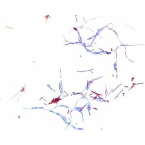Ziehl-Neelsen carbol-fuchsin solution