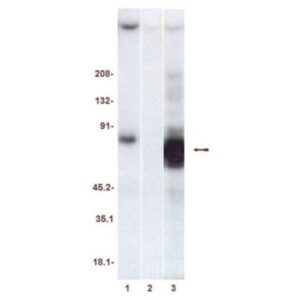 ZAP-70 Protein, active, 20 µg