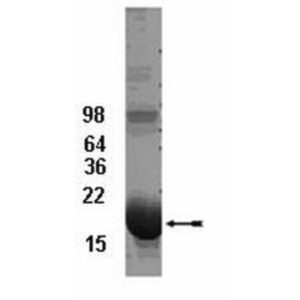 UbcH5b Conjugating Enzyme, 100 µg