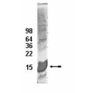 UbcH5c Conjugating Enzyme, 100 µg