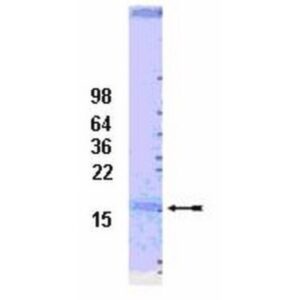 UbcH7 Conjugating Enzyme, 100 µg