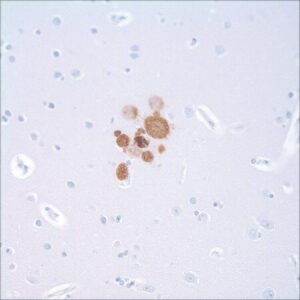 Toxoplasma gondii Rabbit Polyclonal Antibody