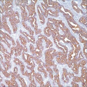 Dextran from Leuconostoc spp.