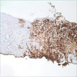 Varicella Zoster Virus (SG1-1, SG1-SG4, NCP-1 & IE-62) Mouse Monoclonal Antibody