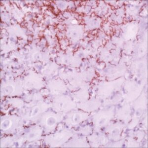Treponema pallidum Rabbit Polyclonal Antibody