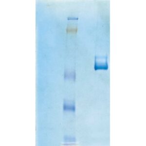 Vitronectin, Human Purified Protein