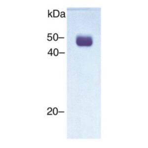 Urokinase-type Plasminogen Activator