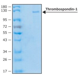 Thrombospondin-1 human