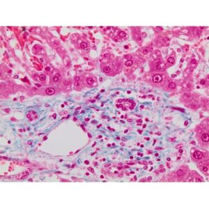 Trichrome Stain LG Solution