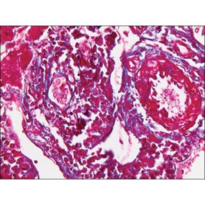 Trichrome Stain AB Solution