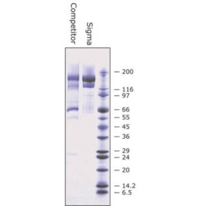 α₂-Macroglobulin from human plasma
