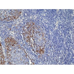 TOP2A (Topoisomerase IIα) Rabbit Monoclonal Antibody