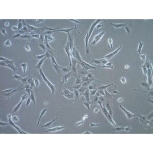 TS/A Mouse Mammary Adenocarcinoma Cell Line