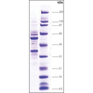 TFIIE, α+β subunits human