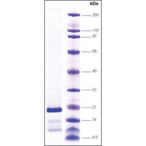 Topo I (C651-765) (C terminal domain) human