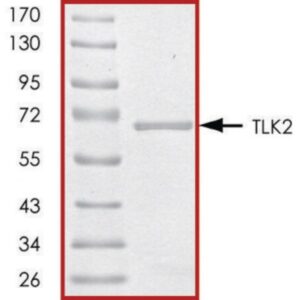TLK2 (388-end), active, GST tagged human