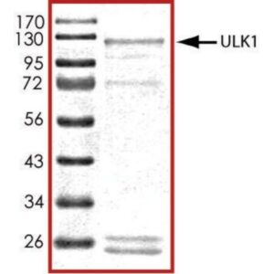 ULK1 (1-649), active, GST tagged human