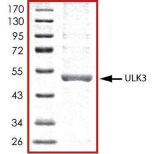 ULK3, active, His tagged human