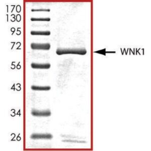 WNK1 (181-507), active, GST tagged human