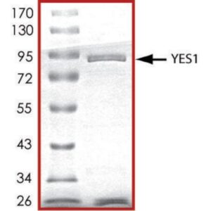 YES1, active, GST tagged human