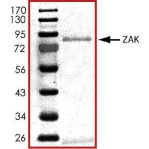 ZAK, active, GST tagged human