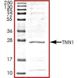 Troponin1, His tagged human