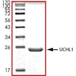 UCHL1, His tagged human