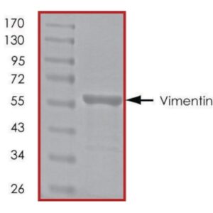 Vimentin, His tagged human