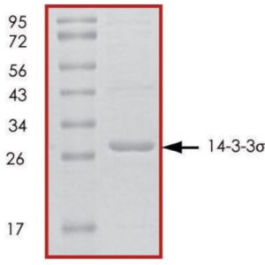 14-3-3 σ, untagged human