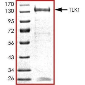 TLK1, active, GST tagged human