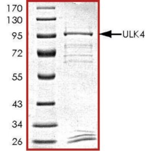 ULK4, GST tagged human