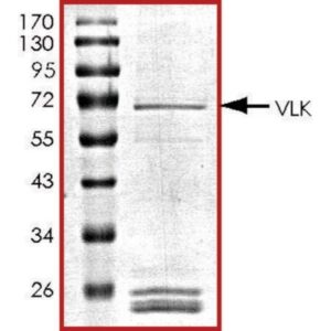 VLK, GST tagged human