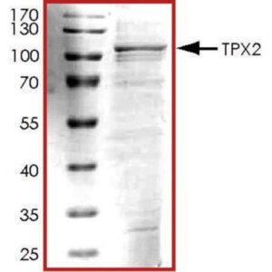 TPX2, His tagged human