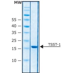 Toxic shock syndrome toxin-1 from Staphylococcus aureus