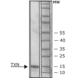 Thioredoxin human