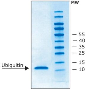 Ubiquitin human