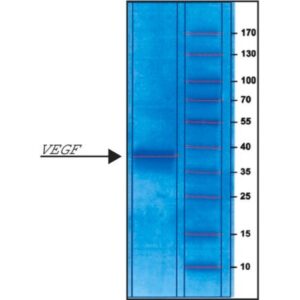 Vascular Endothelial Growth Factor human
