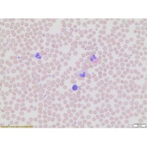 Wright-Giemsa Stain, Modified