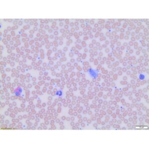 Wright Stain, Modified